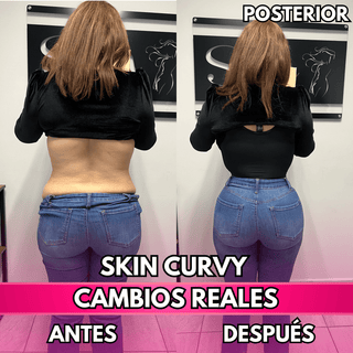 Skin Curvy