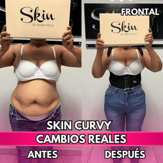 Skin Curvy