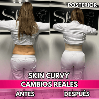 Skin Curvy