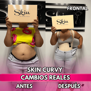 Skin Curvy