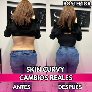 Skin Curvy (50% de descuento)