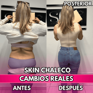 Skin Chaleco (50% de DESCUENTO)