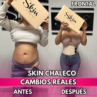 Skin Chaleco (50% de DESCUENTO)