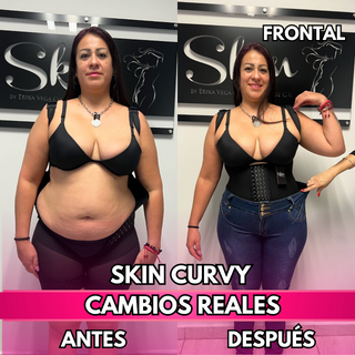 Skin Curvy (50% de descuento)