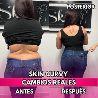 Skin Curvy (50% de descuento)