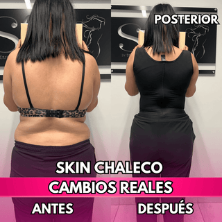 Skin Chaleco (50% de DESCUENTO)