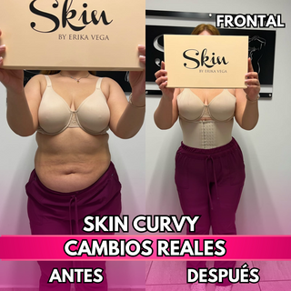 Skin Curvy (50% de descuento)