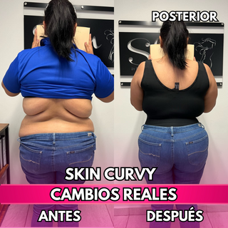 Skin Curvy (50% de descuento)