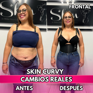 Skin Curvy (50% de descuento)