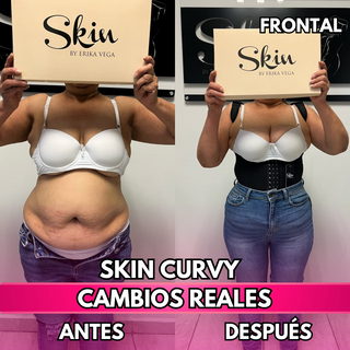 Skin Curvy (50% de descuento)