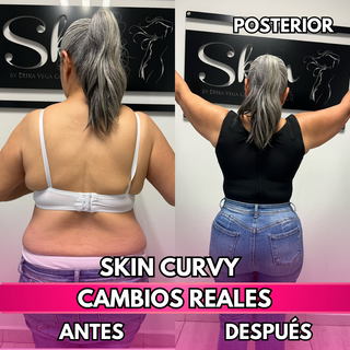 Skin Curvy (50% de descuento)