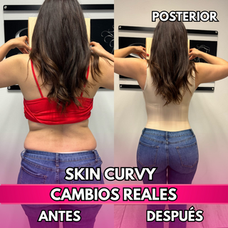 Skin Curvy (50% de descuento)