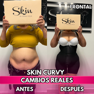 Skin Curvy (50% de descuento)