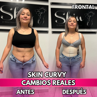 Skin Curvy (50% de descuento)