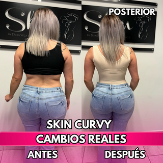 Skin Curvy (50% de descuento)