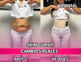 Skin Curvy (50% de descuento)