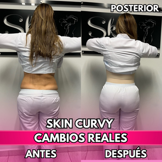 Skin Curvy (50% de descuento)