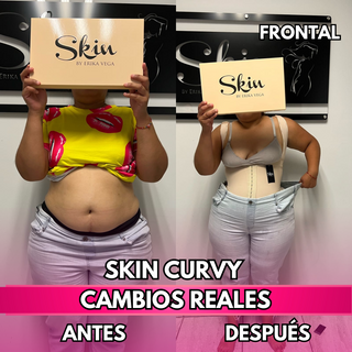 Skin Curvy (50% de descuento)