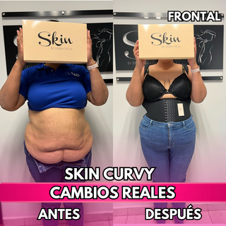 Skin Curvy (50% de descuento)