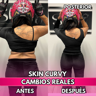 Skin Curvy (50% de descuento)